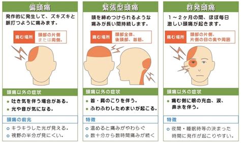 頭頂頭痛 原因|頭頂部の頭痛：医師が考える原因と対処法｜症状辞典 